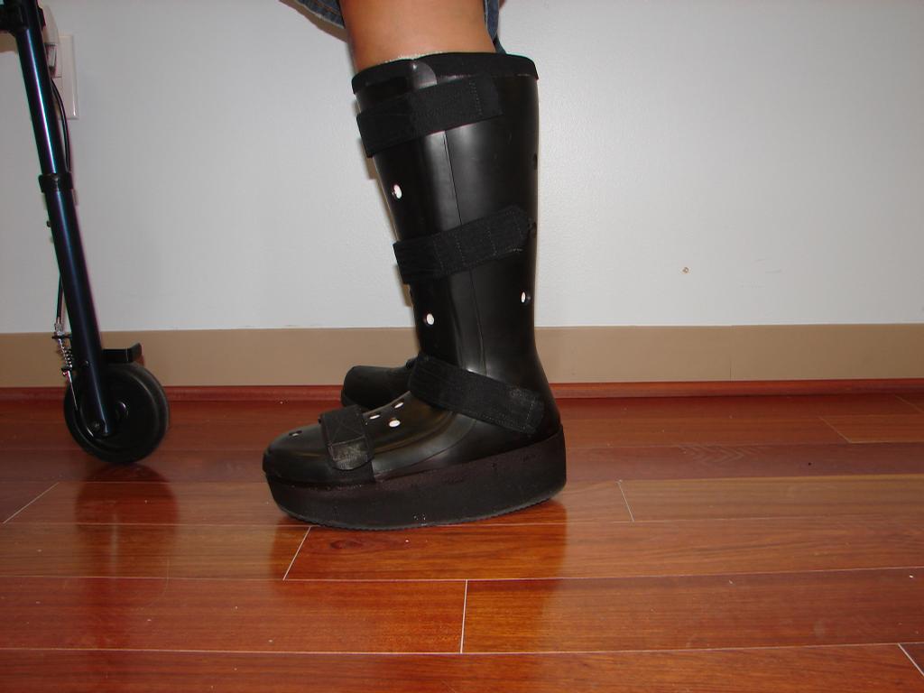 Wear Shoes For Charcot Foot To Support Your Ankle And Feet.