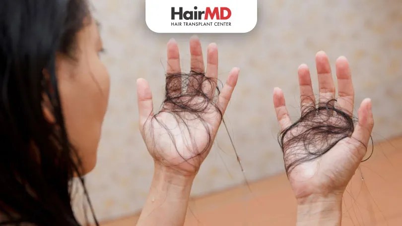5 Tips to Prevent Hair Fall due to Shower