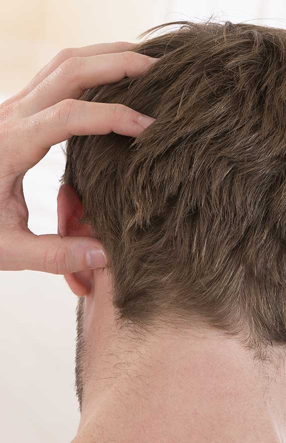 Hair Loss Solutions Hair Prosthesis Centre