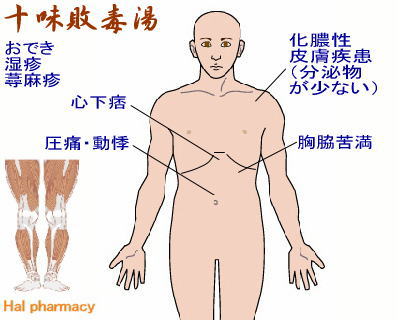十味敗毒湯とは？期待できる3つの効果や副作用、クラシエとツムラの違いについて解説 コタロー 十味敗毒湯 エキス細粒 N6 通販 注文 市販 | ハル薬局