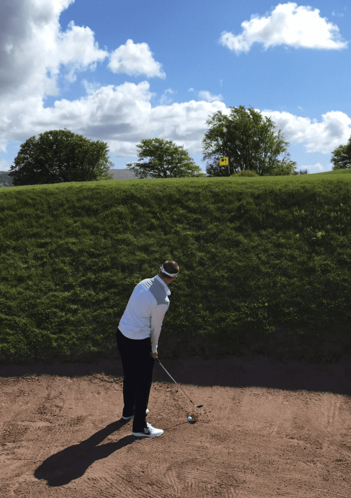 Hand Surgery & Orthopedic Surgery Columbus, OH Hand, Wrist and Arm