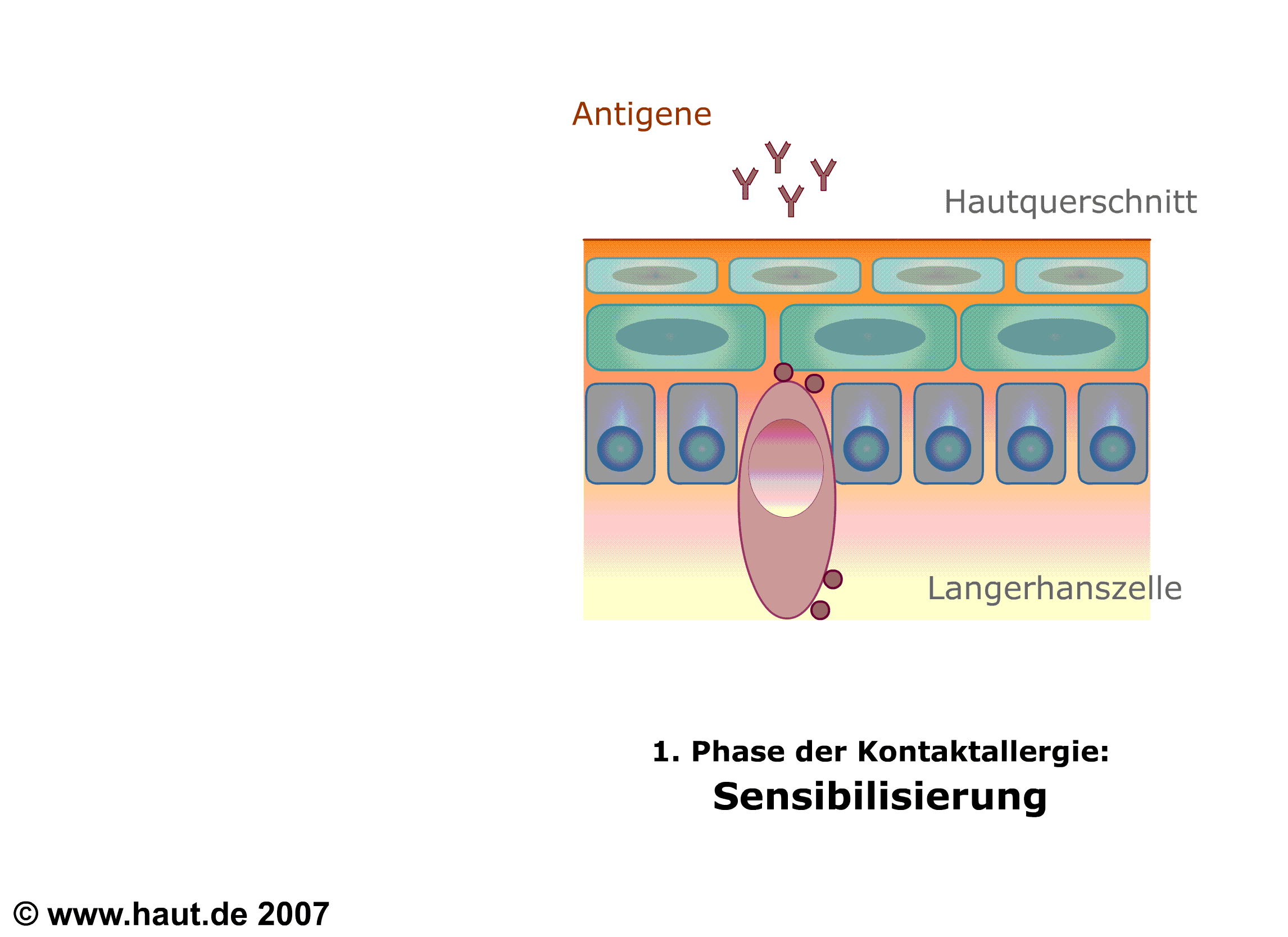 Allergien Grundlagen haut.de