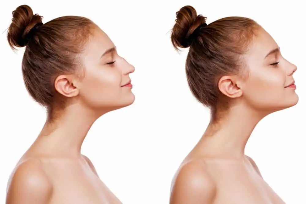 How Much Does The Average Rhinoplasty Cost? HayatMed
