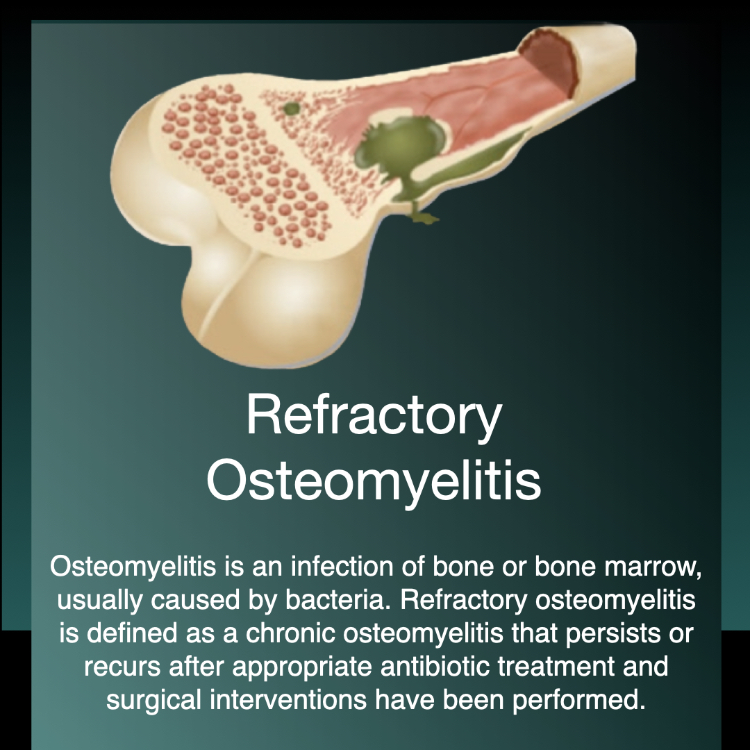 Refractory Osteomyelitis