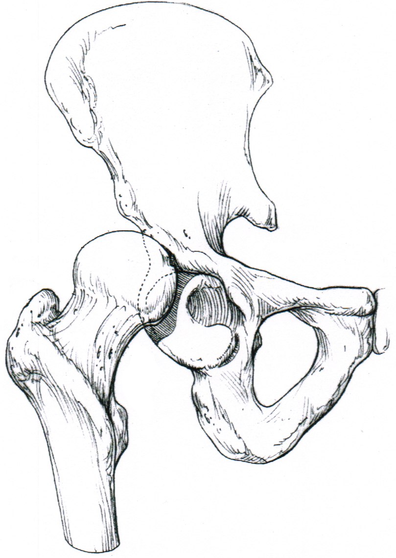 Hip Anatomy, Pictures, Function, Problems & Treatment