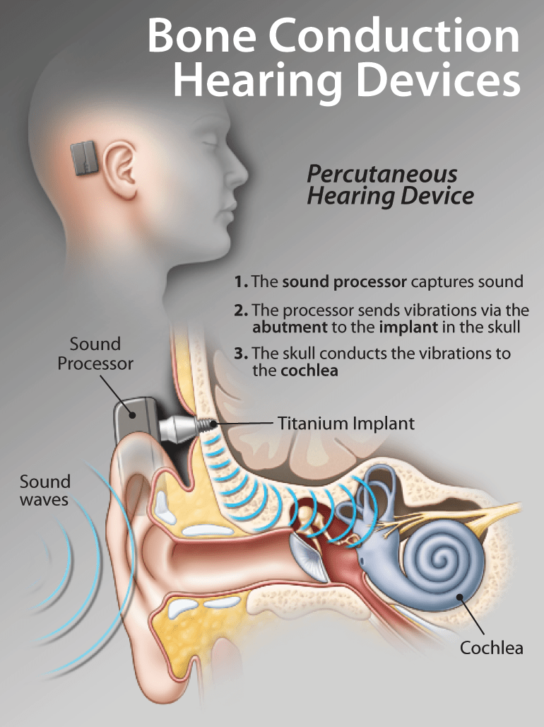 Hearing Loss in the Older Adult