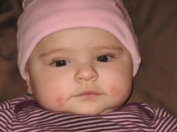 Baby Teething Signs, Timeline and Best Pain Relieving Tips