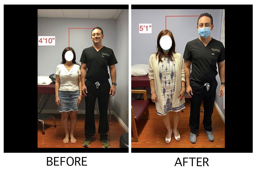 Before & After Gallery Height Lengthening