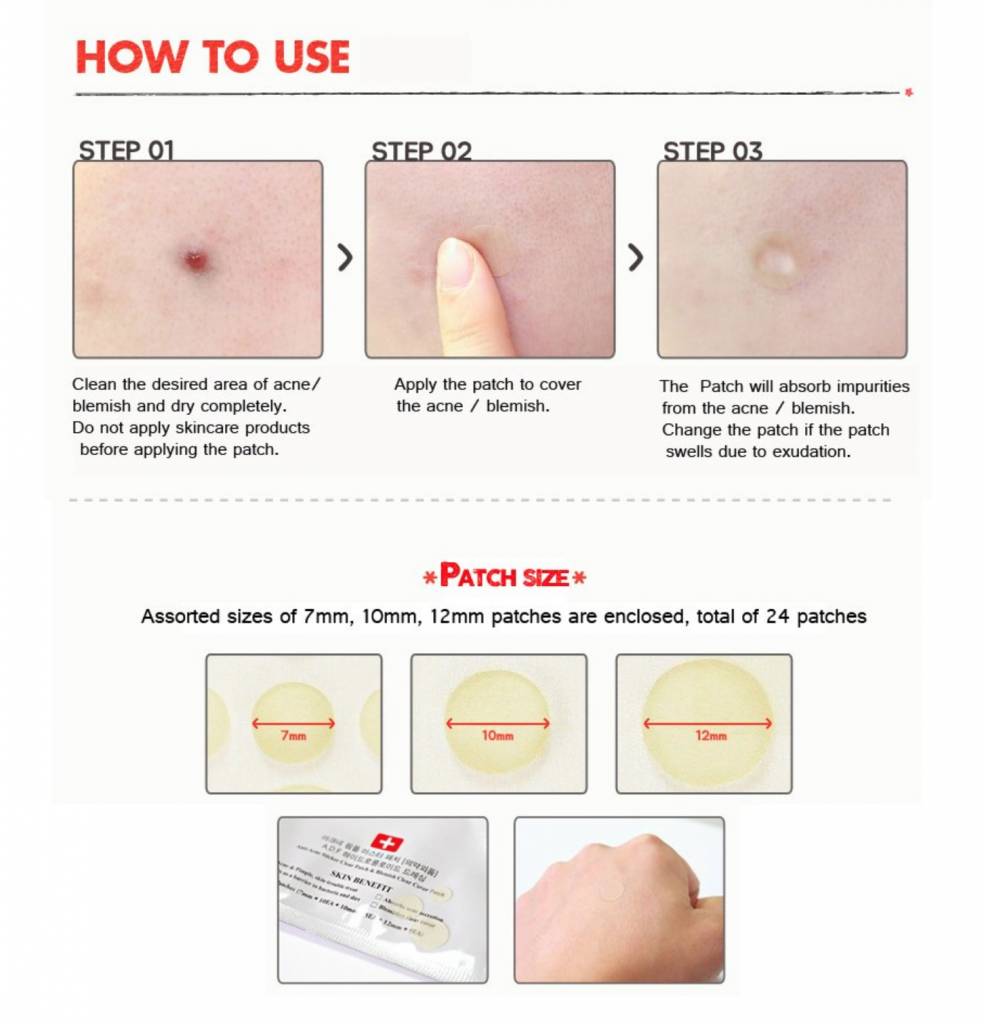 Acne Stickers Pimple Blemish Spot Stickers for facial treatment