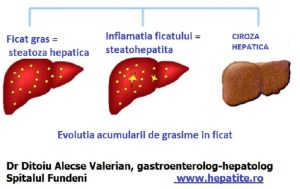 steatoza-hepatica