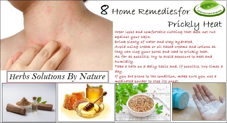 8 Home Remedies for Prickly Heat That Work Rapidly Herbs Solutions By