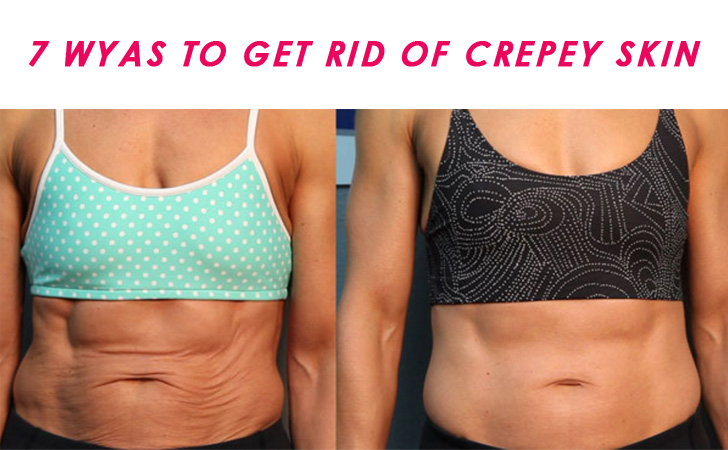 7 Tips on How to Get Rid of Crepey Skin Her Style Code