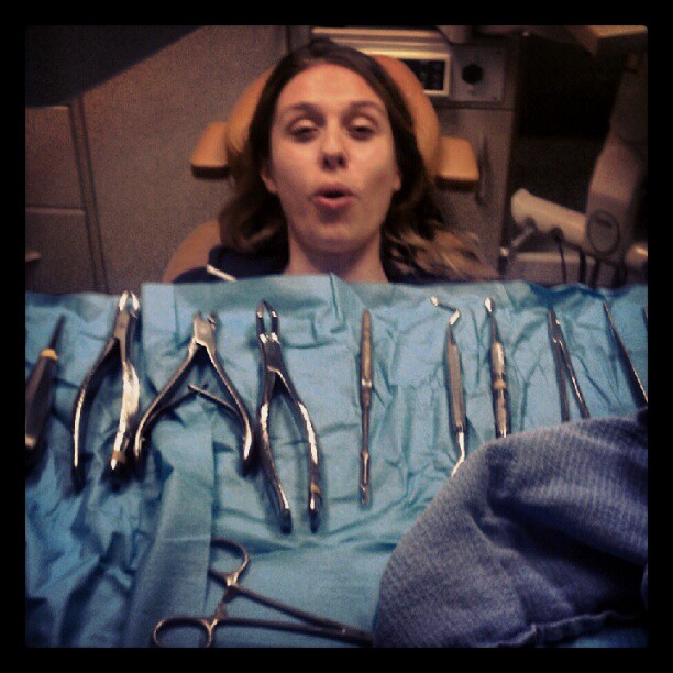 How To Get Rid Of Hard Swelling After Wisdom Teeth Removal How to