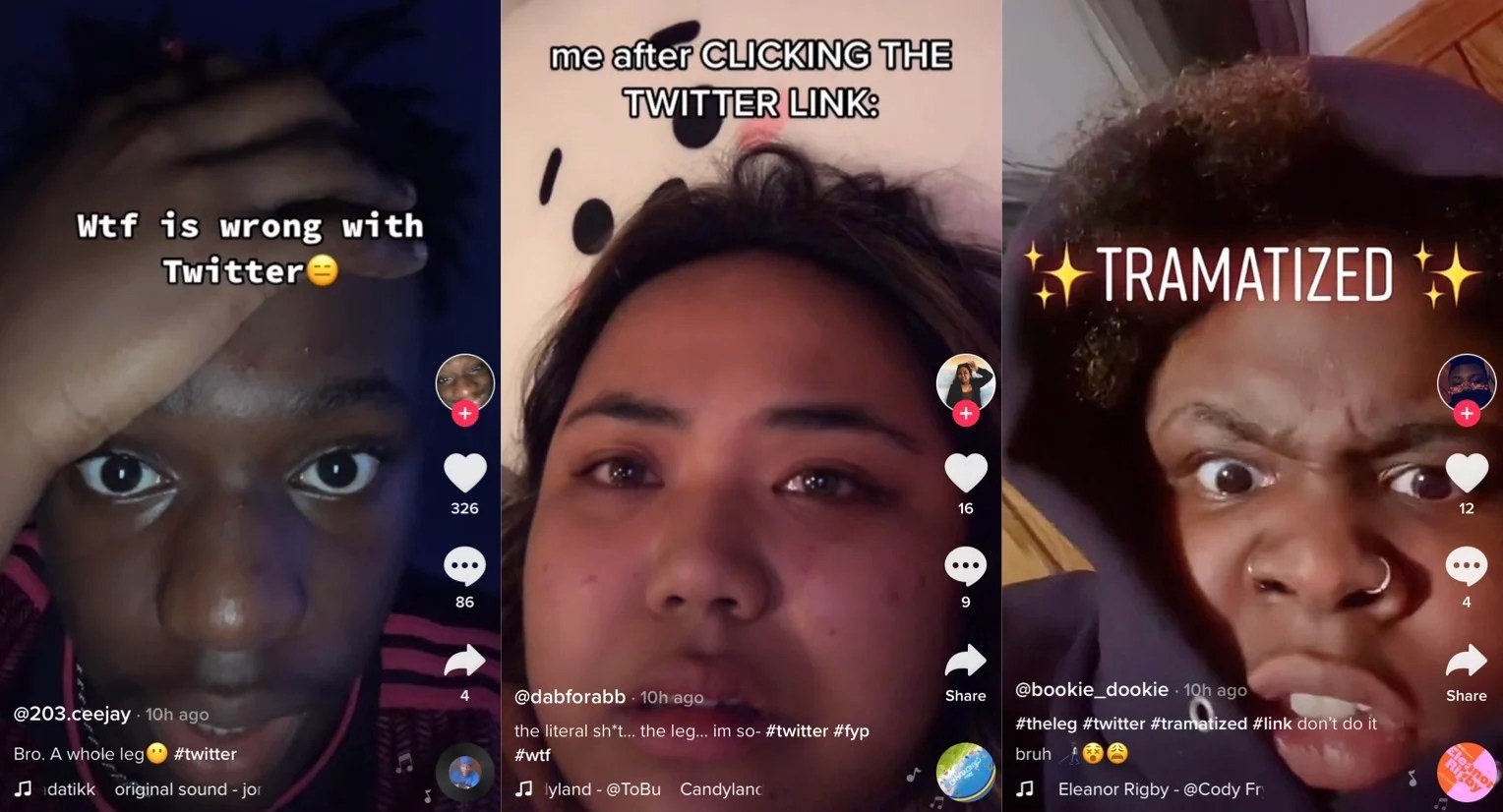 Tiktok Reacts To That 'Traumatising' Leg Video From Twitter