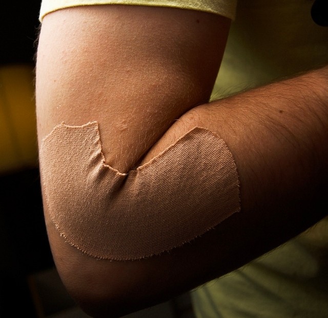 Injury Claim Elbow Injury Claim