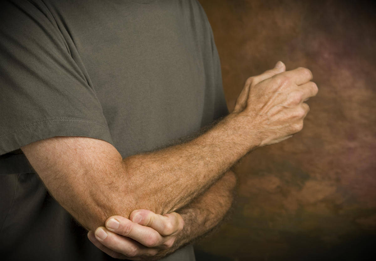 Missouri Workers’ Compensation for Epicondylitis