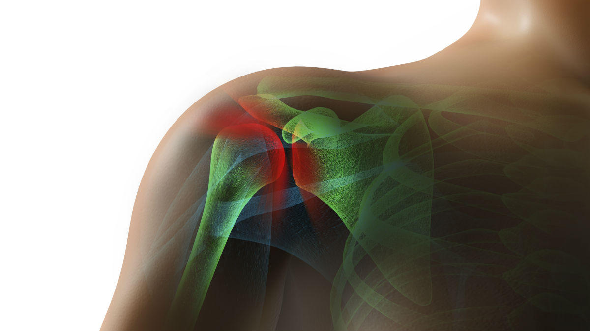 Rotator Cuff Tear Lawyer Missouri Workers Comp Attorneys