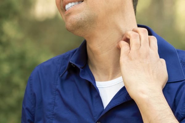 Can You Get Workers’ Compensation Benefits for Insect