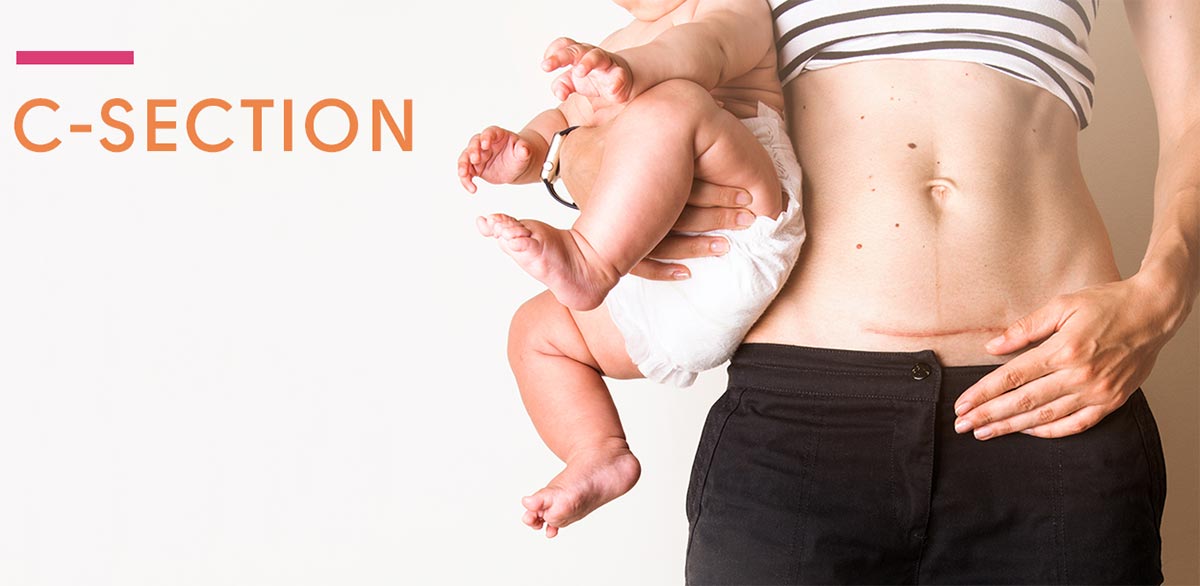 Holistic Core Restore® CSection Recovery Holistic Core Restore