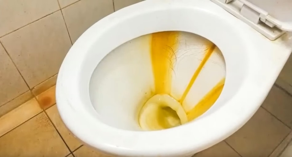 How To Get Rid Of Yellow Stains In A Toilet at Celinda Howell blog