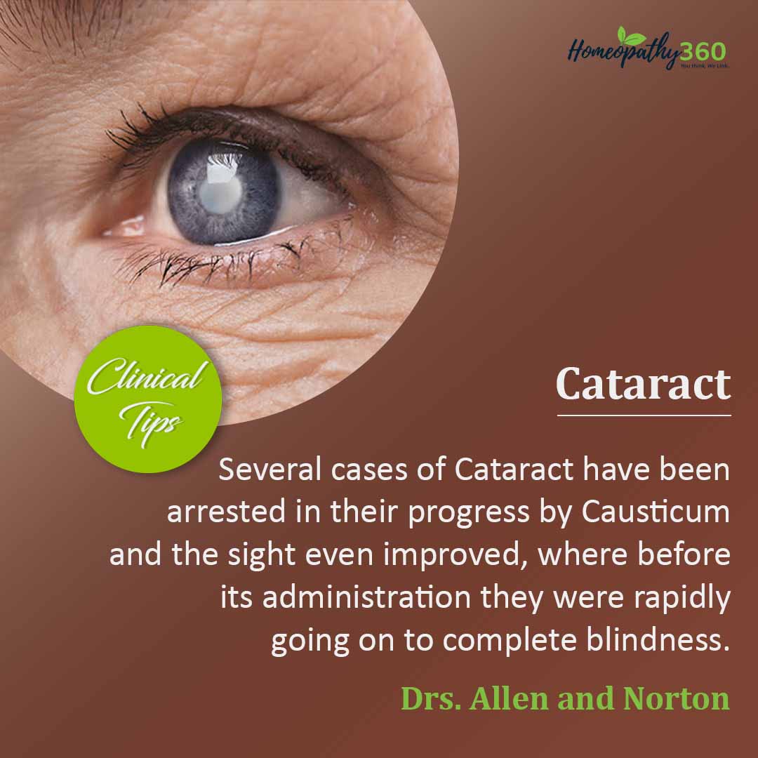 Cataract Clinical Tips by Drs. Allen and Norton homeopathy360