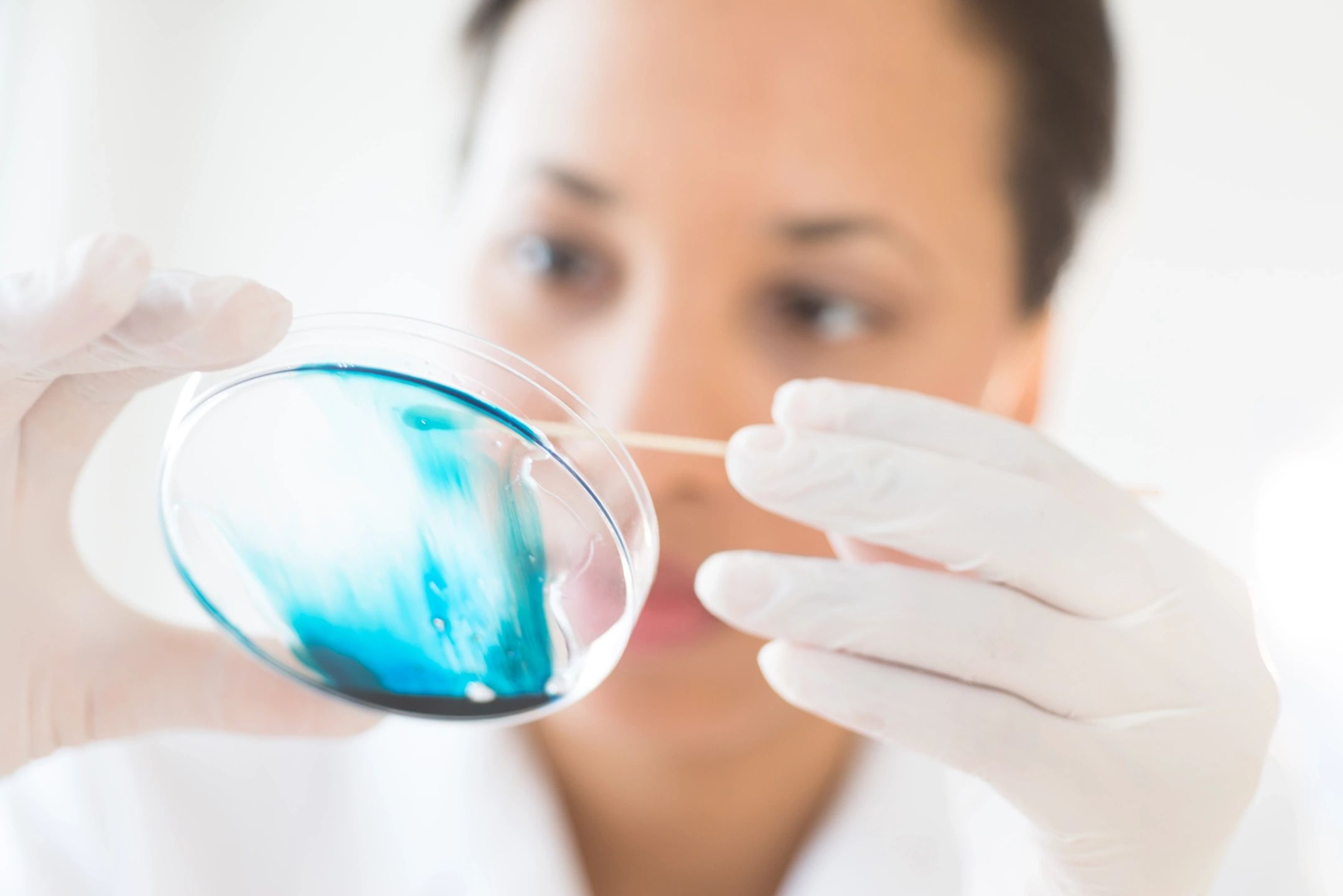 Honeydew Consulting Get the best out of Epic Beaker