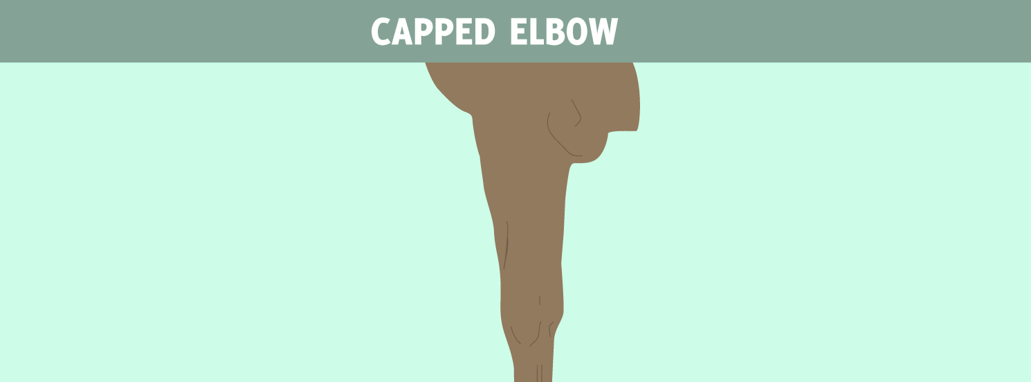 Capped Elbow HorseDVM Diseases AZ