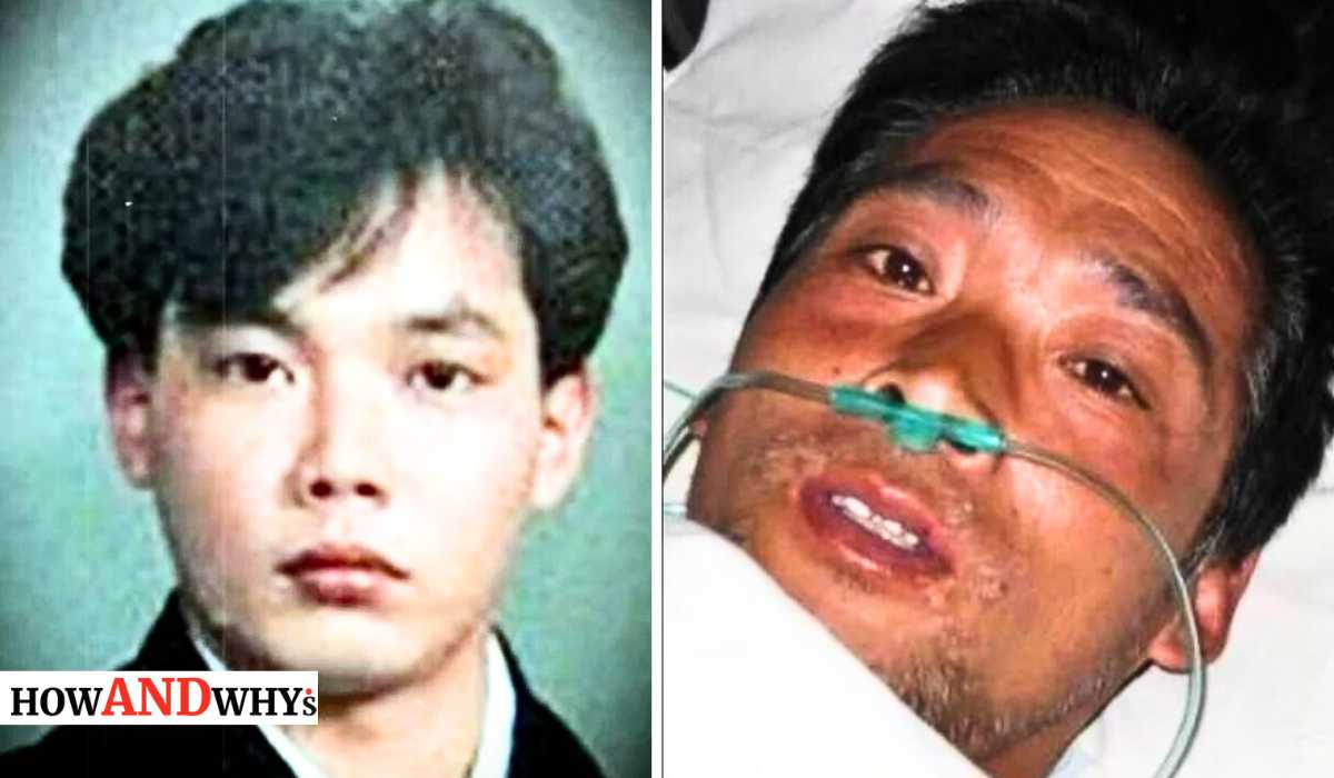Hisashi Ouchi Was Kept Alive for 83 Days After Absorbing Nuclear