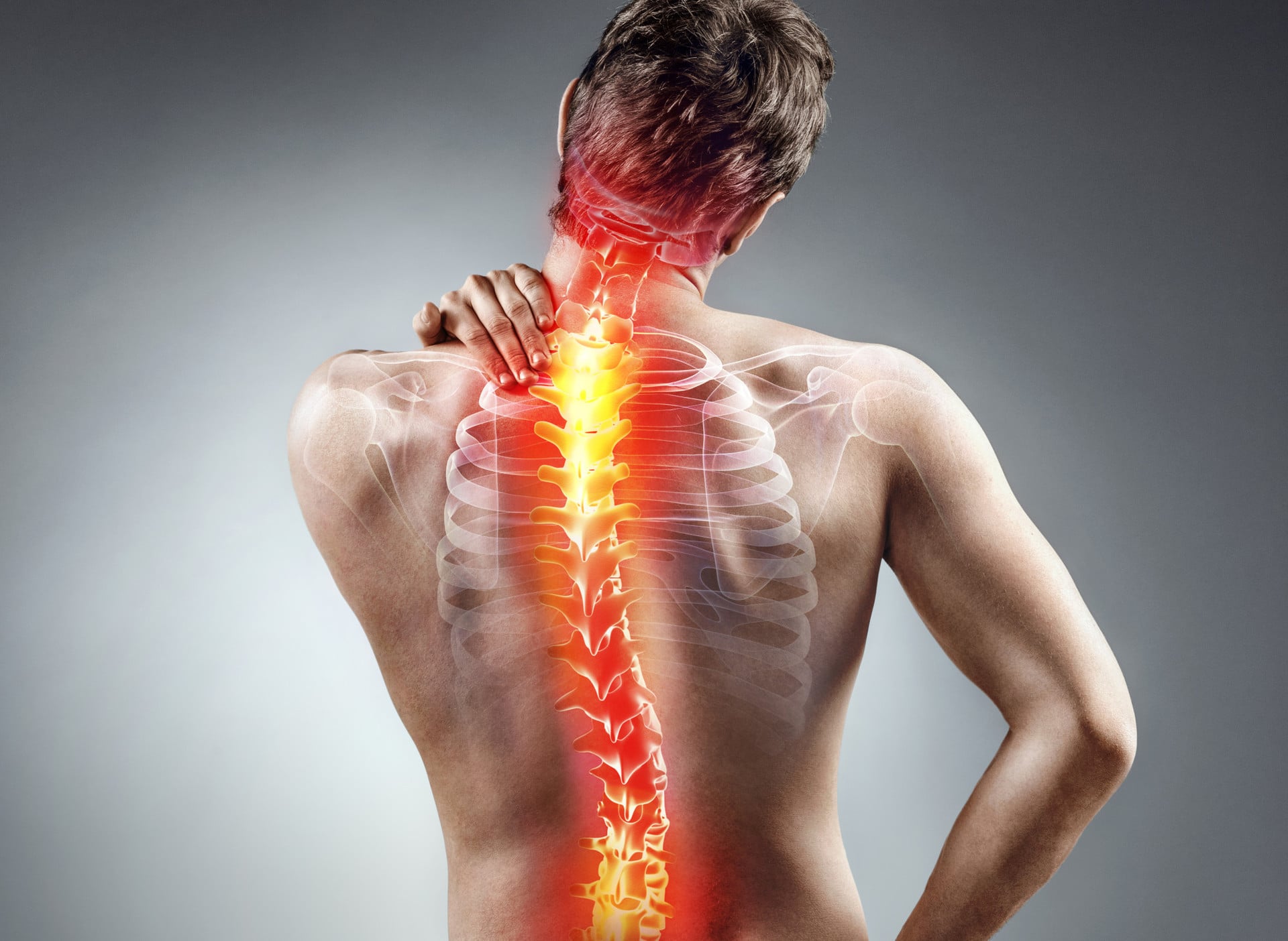 The Most Common Types of Spine Conditions, Explained