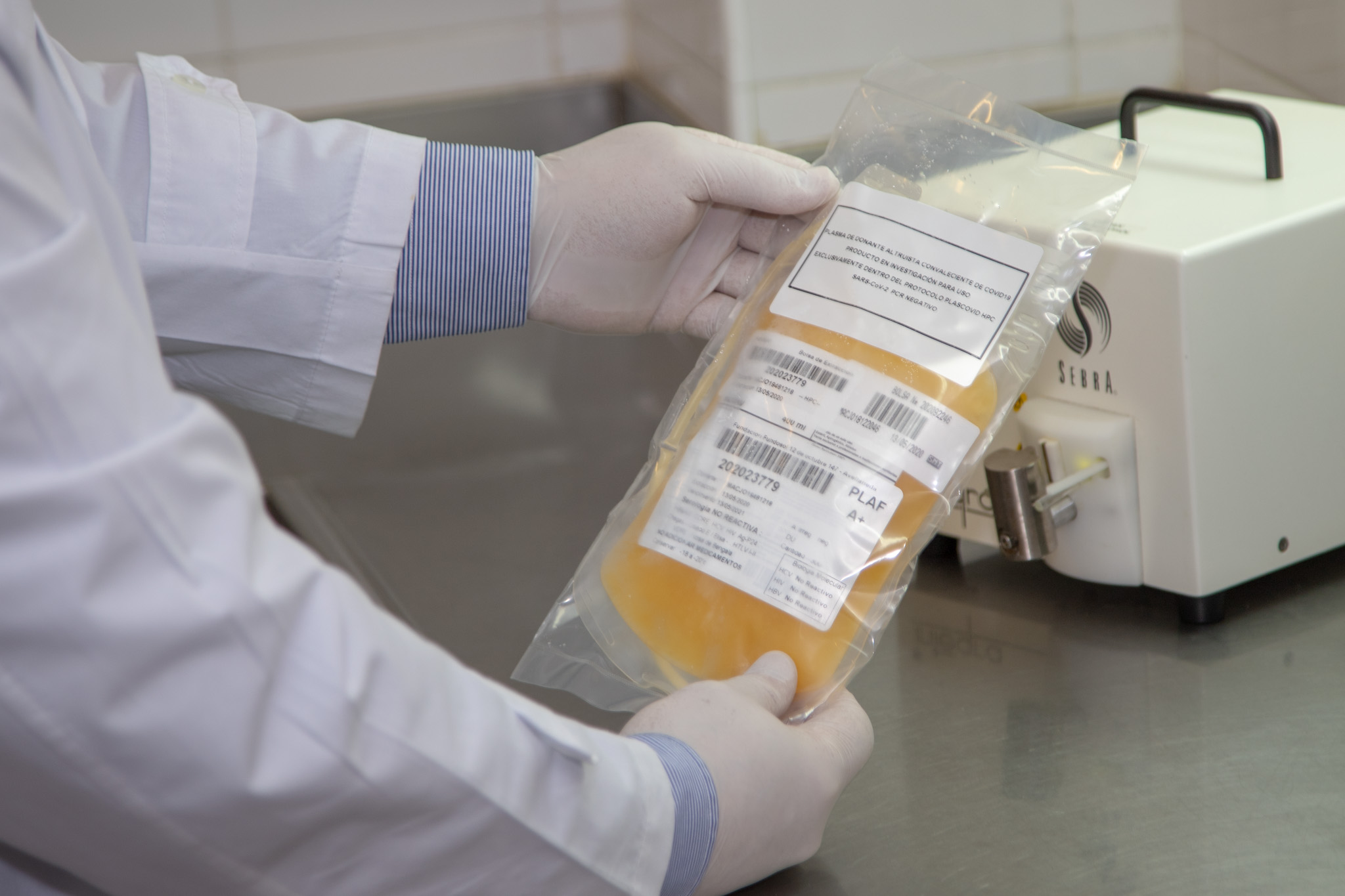 La donación de plasma para pacientes con COVID19 HPC