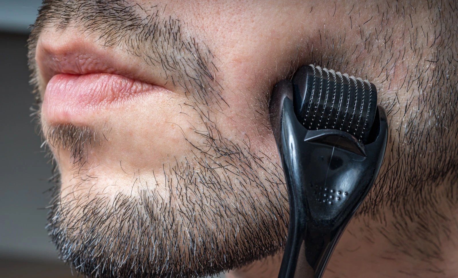 Do Beard Rollers Work? Do Derma Rollers Work for Beard Growth?