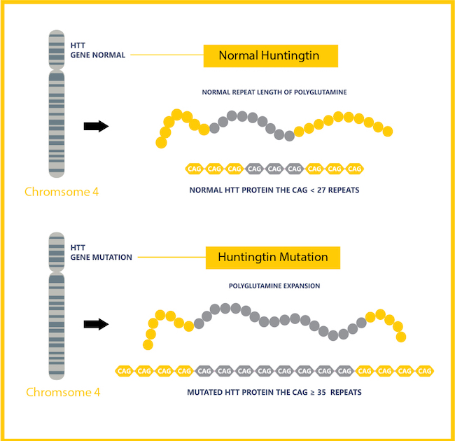 Huntington’s Disease Research Shutting down the mutant gene