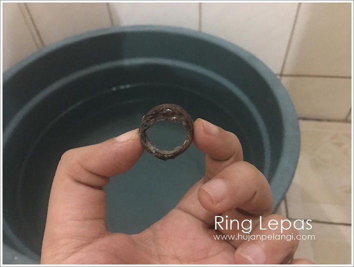 Pengalaman Si Kecil Sunat Super Ring Hujanpelangi Blog