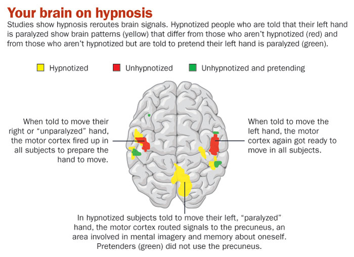 Can I Be Hypnotized? CLICK HERE To Find Out Right NOW!