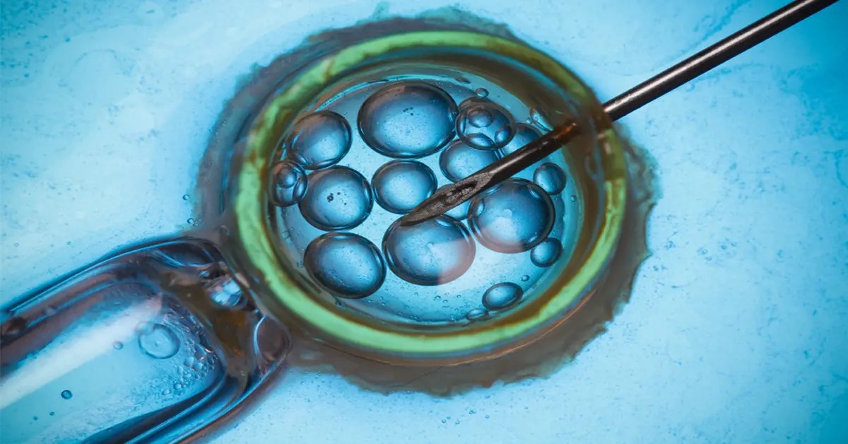 Assisted Reproductive Technology UPSC