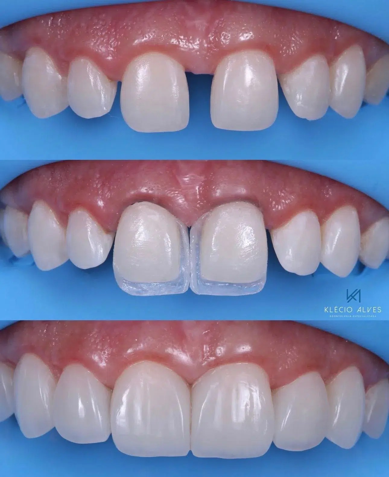 Smile Gallery Dentist in Bellerose Iconic Smiles