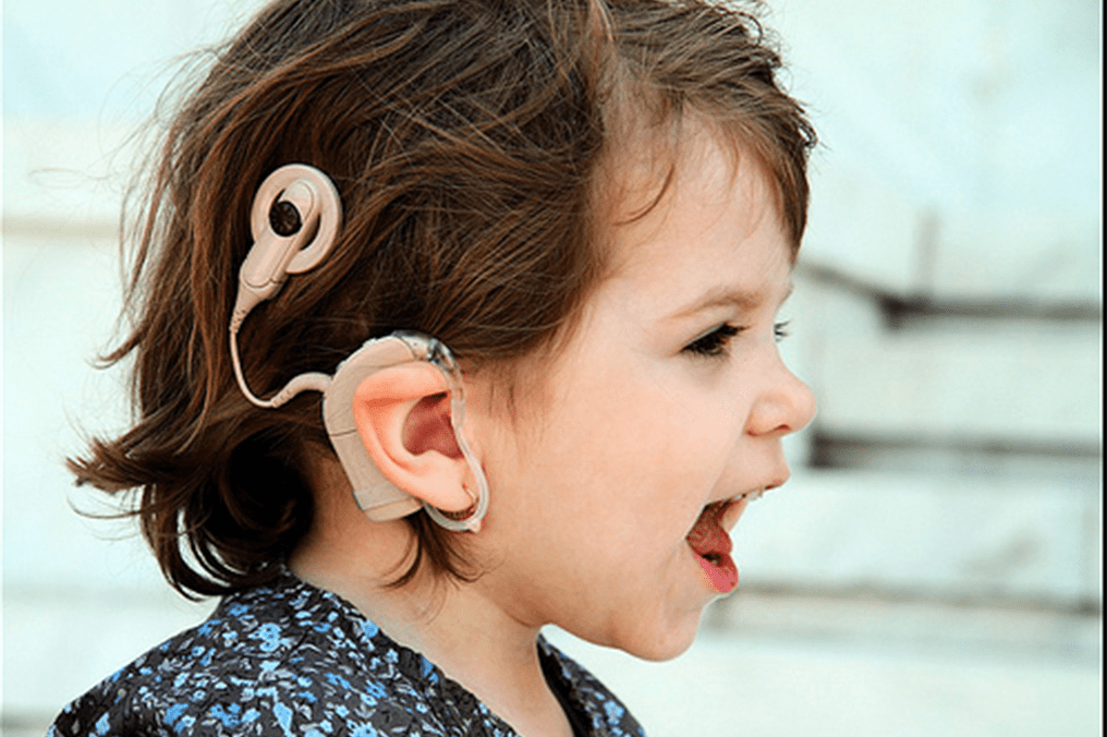 Electrode arrays for nerve stimulation in cochlear implants ICsense