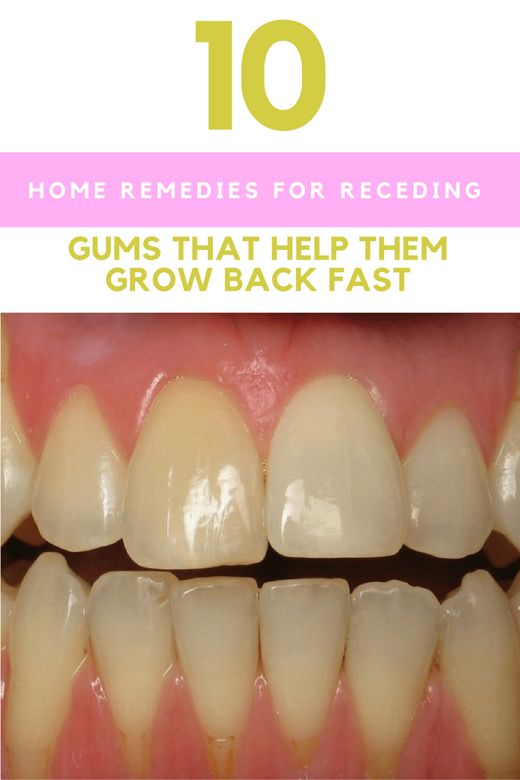 10 Home Remedies For Receding Gums That Help Them Grow Back Fast