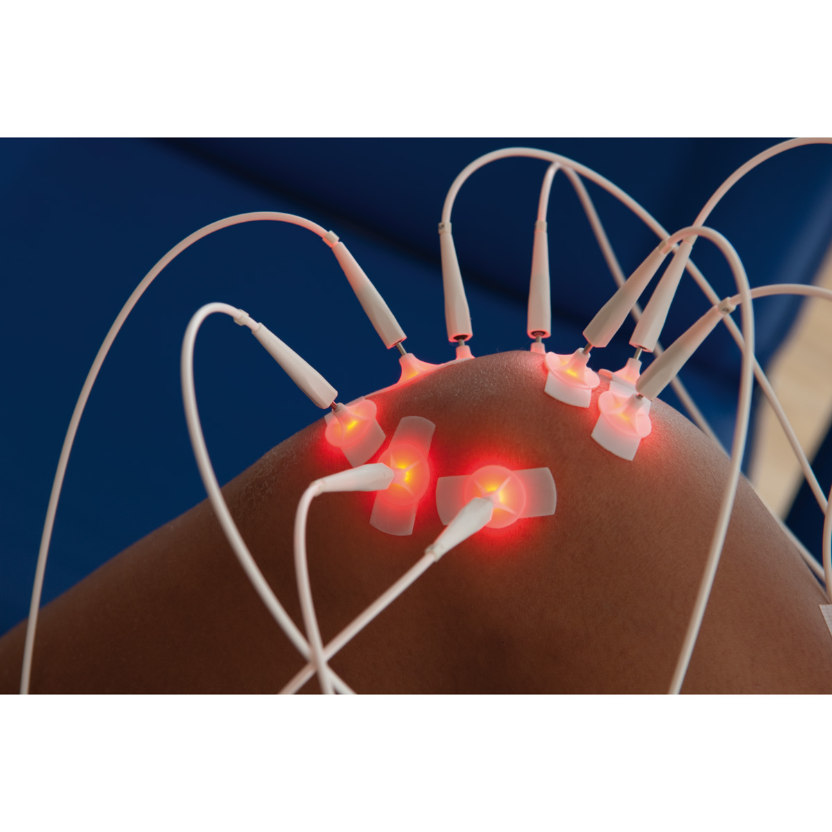 Bayonne Physical Therapy, Acupuncture, Weight Loss, Massage & MLS Laser