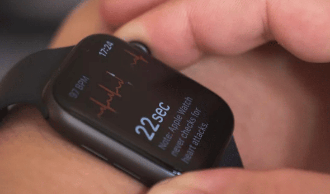 AFib and blood thinner medication study makes use of Apple Watch to
