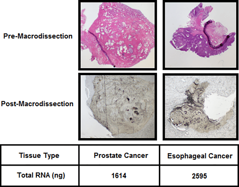 RNA extraction from FFPE tumor tissues Integrated Laboratory Systems