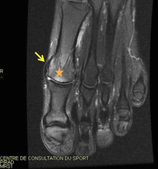 Centre d'imagerie OstéoArticulaire Clinique du sport de Bordeaux