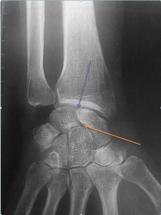 Centre d'imagerie OstéoArticulaire Clinique du sport de Bordeaux