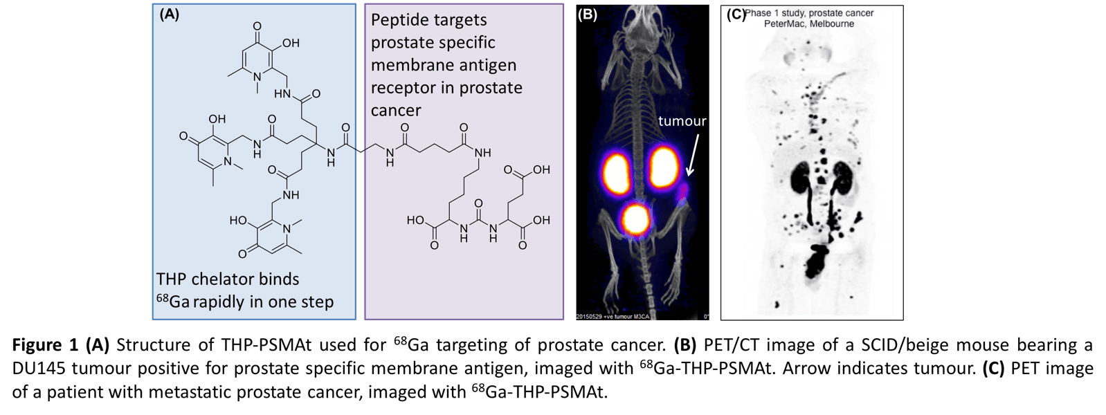 New chelators for versatile coordination of PET, SPECT and