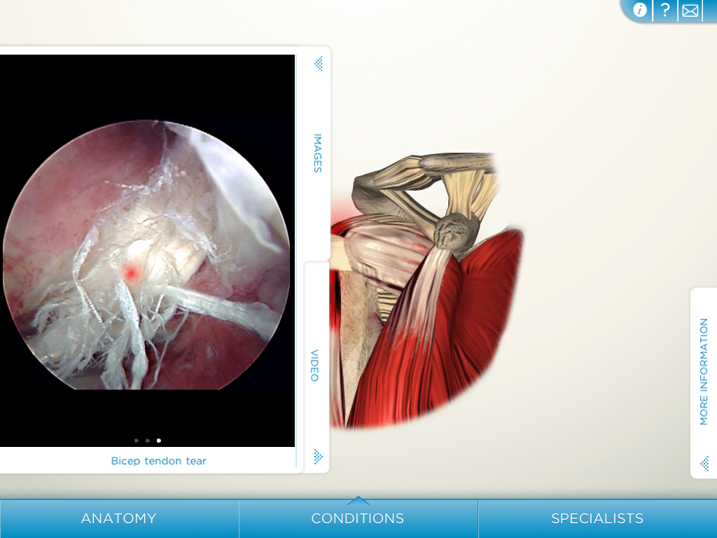 Shoulder Decide App Review