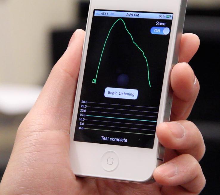 UW researchers transform smartphone into spirometer with mobile app