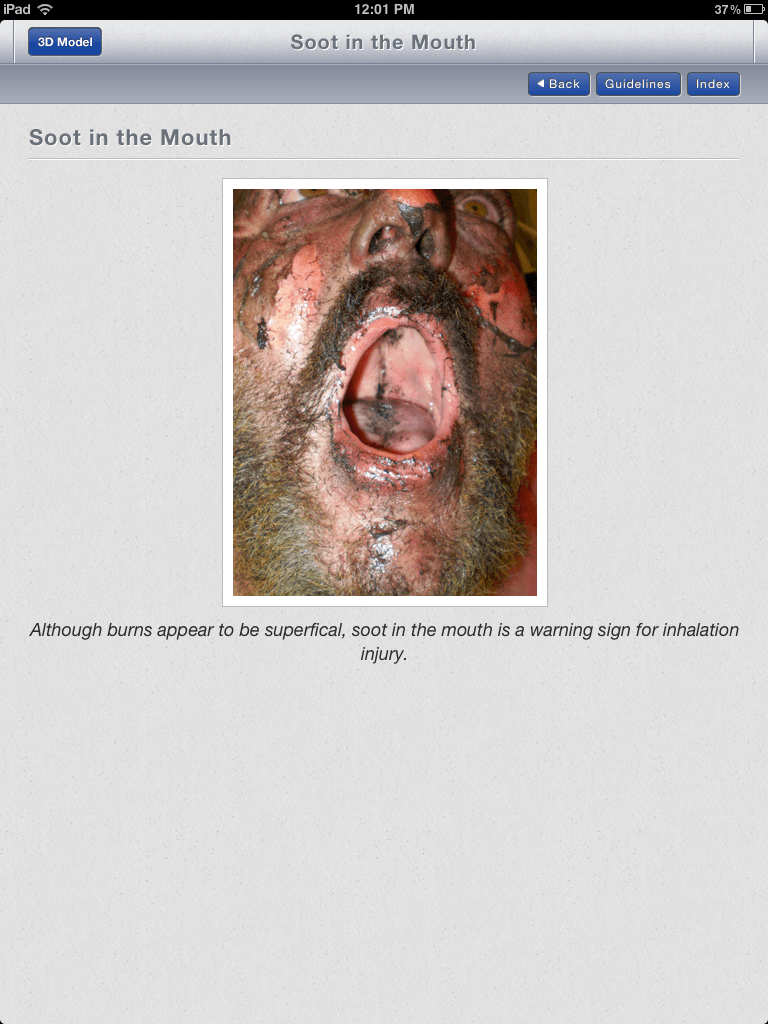 Review of burn management app created by Johns Hopkins Physician