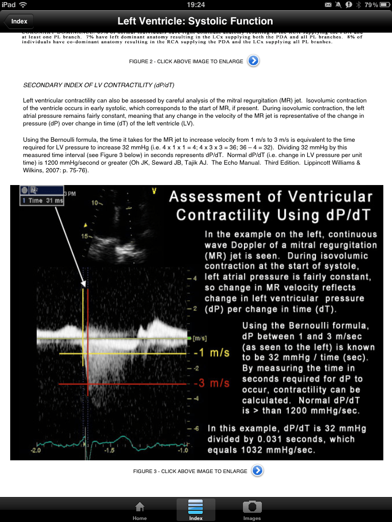 EchoSource app is a useful introduction to echocardiography