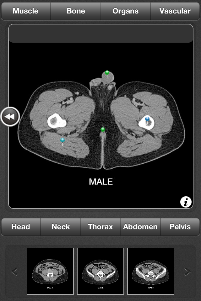 CT Anatomy app helps users learn general anatomy using