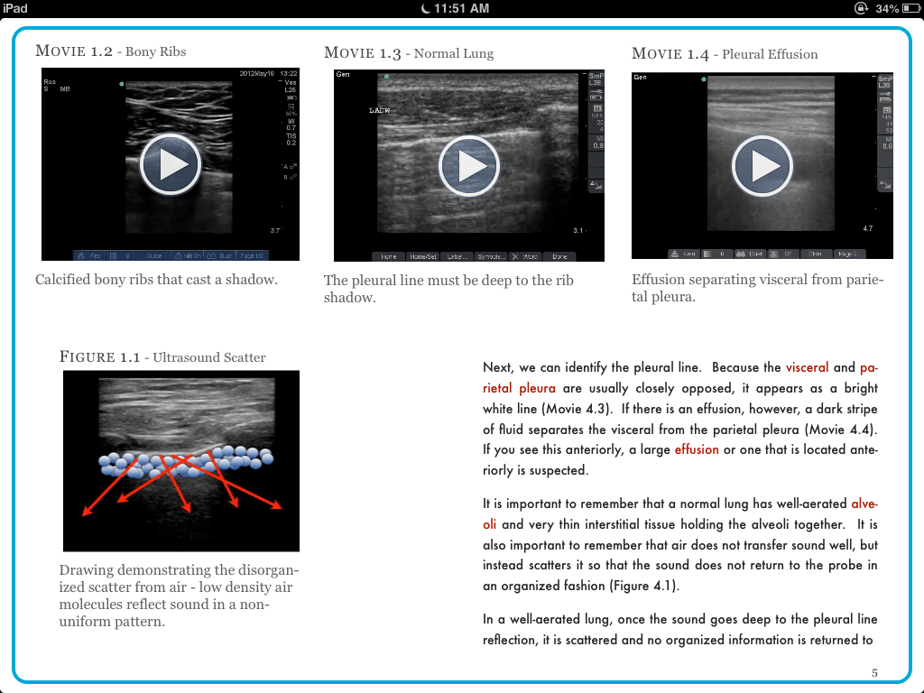 Introduction to Bedside Ultrasound is the first complete interactive